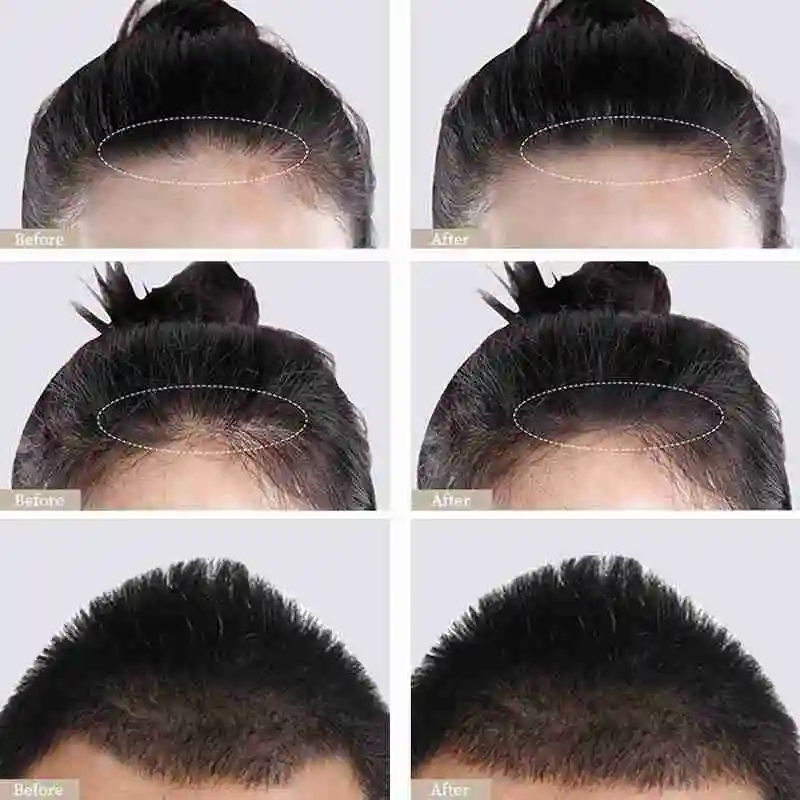 4G Waterproof Hair Shadow Powder Edge Control 3 Colors Concealer Powder Puff Cover Line Hair with Hair Hair Makeup T5D0
4G Waterproof Hair Shadow Powder Edge Control 3 Colors Concealer Powder Puff Cover Line Hair with Hair Hair Makeup T5D0