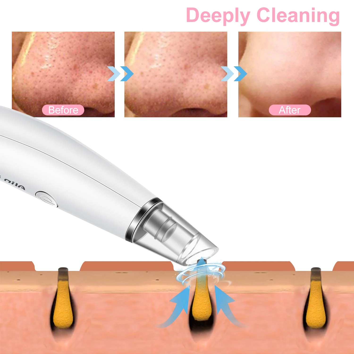 Lemonwald Wireless Charging Vacuum Blackhead Remover, Deep Facial Care, Skin Cleaning, Remove Blackhead, Acne, White Head, Resid
Lemonwald Wireless Charging Vacuum Blackhead Remover, Deep Facial Care, Skin Cleaning, Remove Blackhead, Acne, White Head, Resid