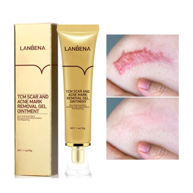 Acne Scar Removal Cream Scar Gel Skin Repair Face Cream Acne Spots Acne Treatment Skin Care Whitening Stretch Marks
Acne Scar Removal Cream Scar Gel Skin Repair Face Cream Acne Spots Acne Treatment Skin Care Whitening Stretch Marks