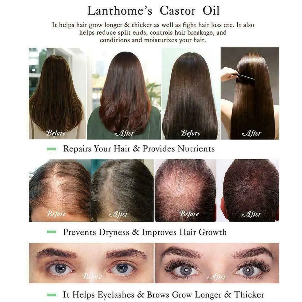 100% Castor Oil Eyelash Nourishing Essential Oil with Brush Stimulate Growth for Eyelashes Eyebrows Hair SMJGood
100% Castor Oil Eyelash Nourishing Essential Oil with Brush Stimulate Growth for Eyelashes Eyebrows Hair SMJGood