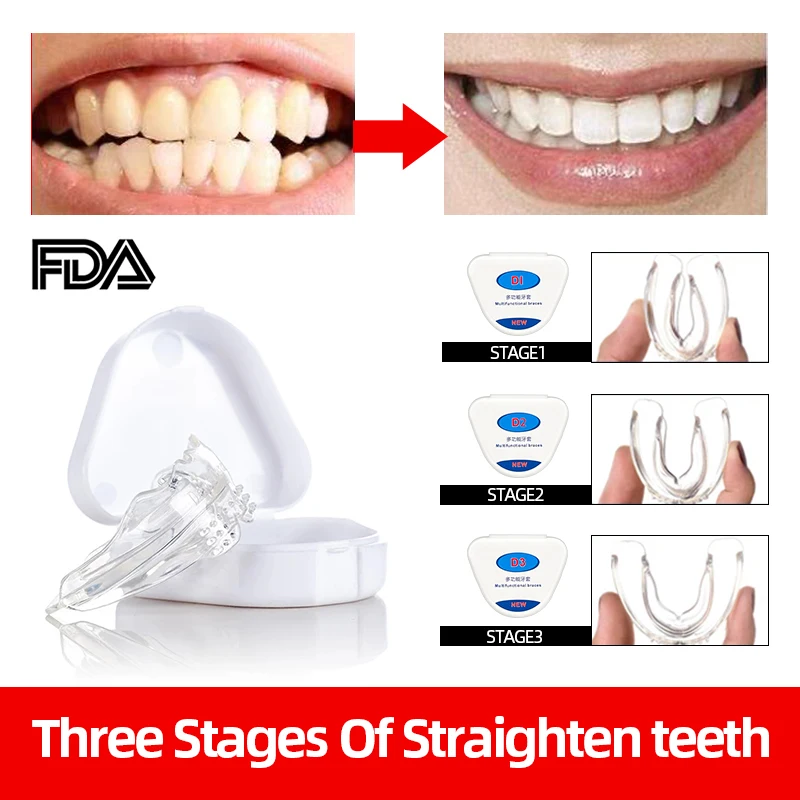 3 Stages Silicone Dental Braces Orthodontic Teeth Retainer Mouth Guard Dental Alignment Care Tool Oral Beauty Health
3 Stages Silicone Dental Braces Orthodontic Teeth Retainer Mouth Guard Dental Alignment Care Tool Oral Beauty Health