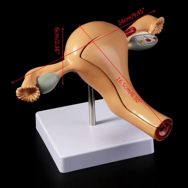 2021 New Human Pathological Uterus Ovary Model Anatomical Anatomy Disease Pathology Lesion For Teaching
2021 New Human Pathological Uterus Ovary Model Anatomical Anatomy Disease Pathology Lesion For Teaching
