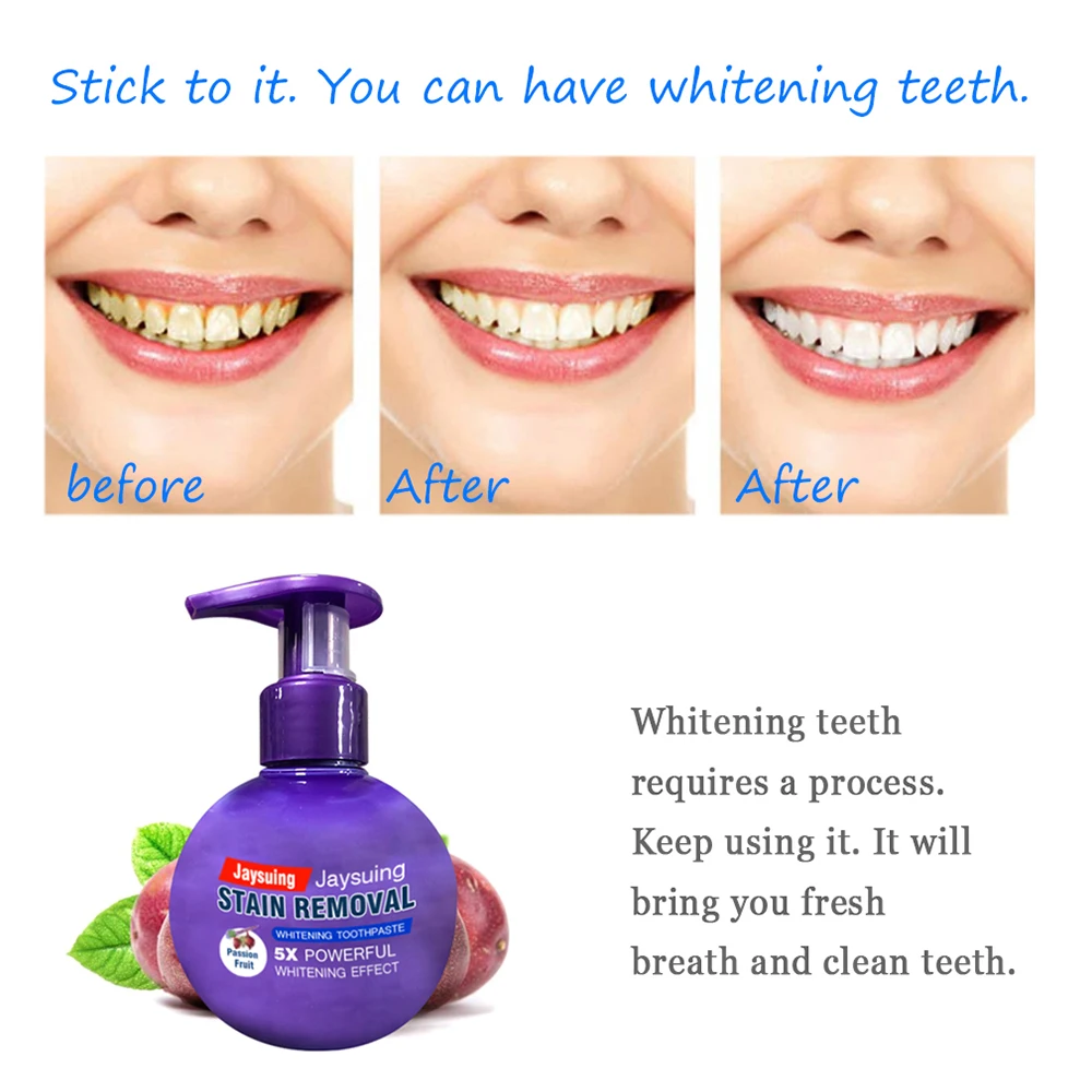 220g Passion Fruit Blueberry Soda Toothpaste Stain Removal Whitening Baking Soda Toothpaste Fight Bleeding Gums Toothpaste
220g Passion Fruit Blueberry Soda Toothpaste Stain Removal Whitening Baking Soda Toothpaste Fight Bleeding Gums Toothpaste