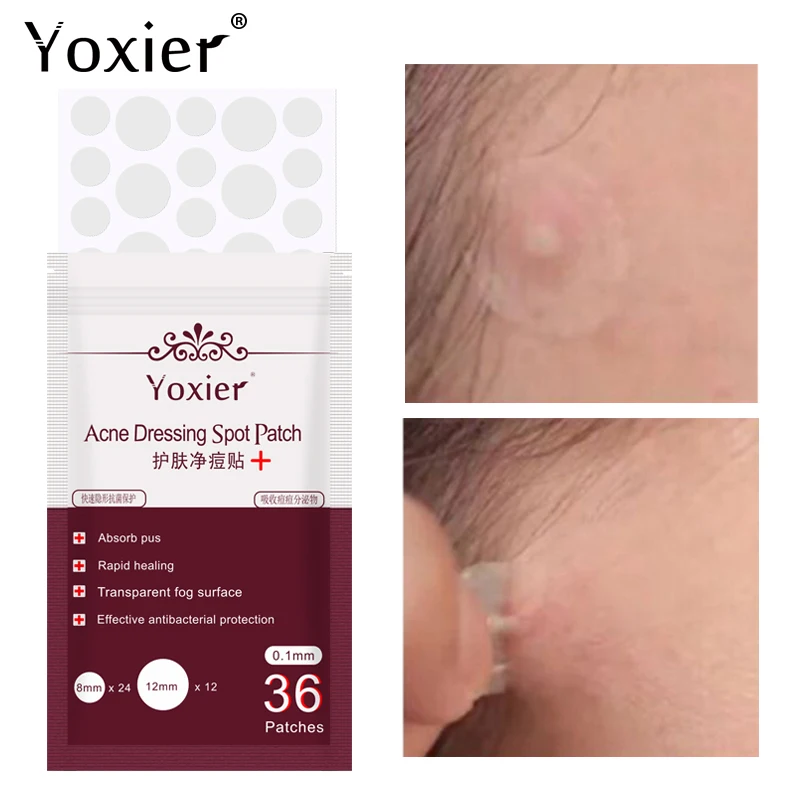 Yoxier 36 шт. патчи против прыщей Ance уход за кожей водостойкие лечебные наклейки маска для лица инструмент для удаления пятен крем для лица
Yoxier 36 шт. патчи против прыщей Ance уход за кожей водостойкие лечебные наклейки маска для лица инструмент для удаления пятен крем для лица
