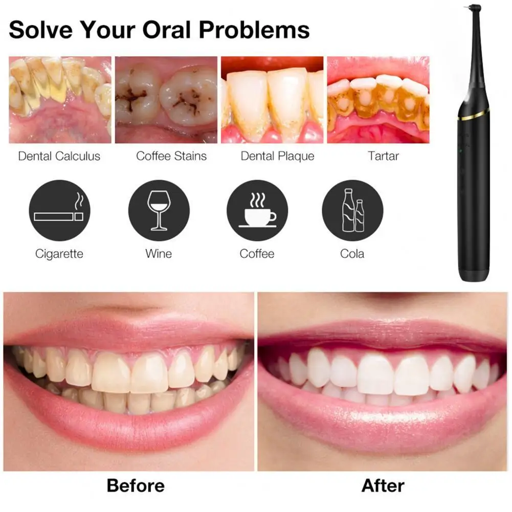 Useful Practical Gum Care Tartars Remover Portable Tooth Cleaner Rechargeable for Travel
Useful Practical Gum Care Tartars Remover Portable Tooth Cleaner Rechargeable for Travel