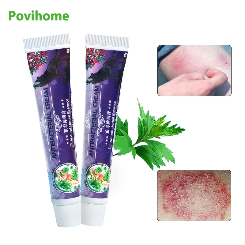 20g/pc Psoriasis Ointment Antibacterial Dermatitis Eczema Wolf Venom Anti-itch Cream Skin Care Herbal Chinese Medical Oil
20g/pc Psoriasis Ointment Antibacterial Dermatitis Eczema Wolf Venom Anti-itch Cream Skin Care Herbal Chinese Medical Oil