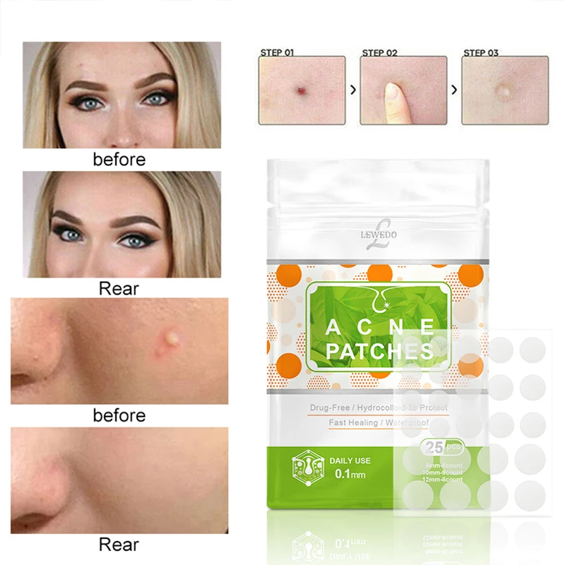 Sevich Pimple Invisible Stickers Acne Party Urgent Required Concealer Acne Patches Unisex 25pcs
Sevich Pimple Invisible Stickers Acne Party Urgent Required Concealer Acne Patches Unisex 25pcs