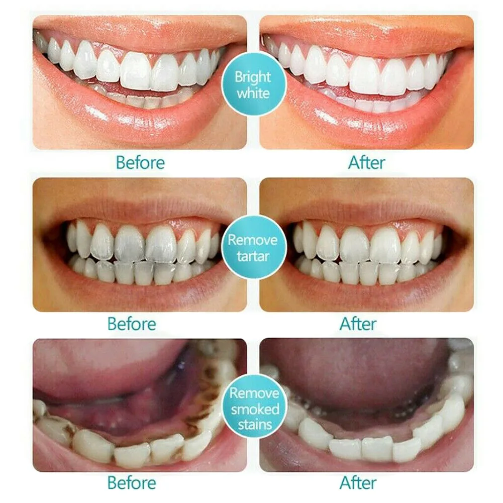 Toothpaste Foam Toothpaste Remove Tooth Stains Whitening Stain Remover for Brushing Teeth J9
Toothpaste Foam Toothpaste Remove Tooth Stains Whitening Stain Remover for Brushing Teeth J9