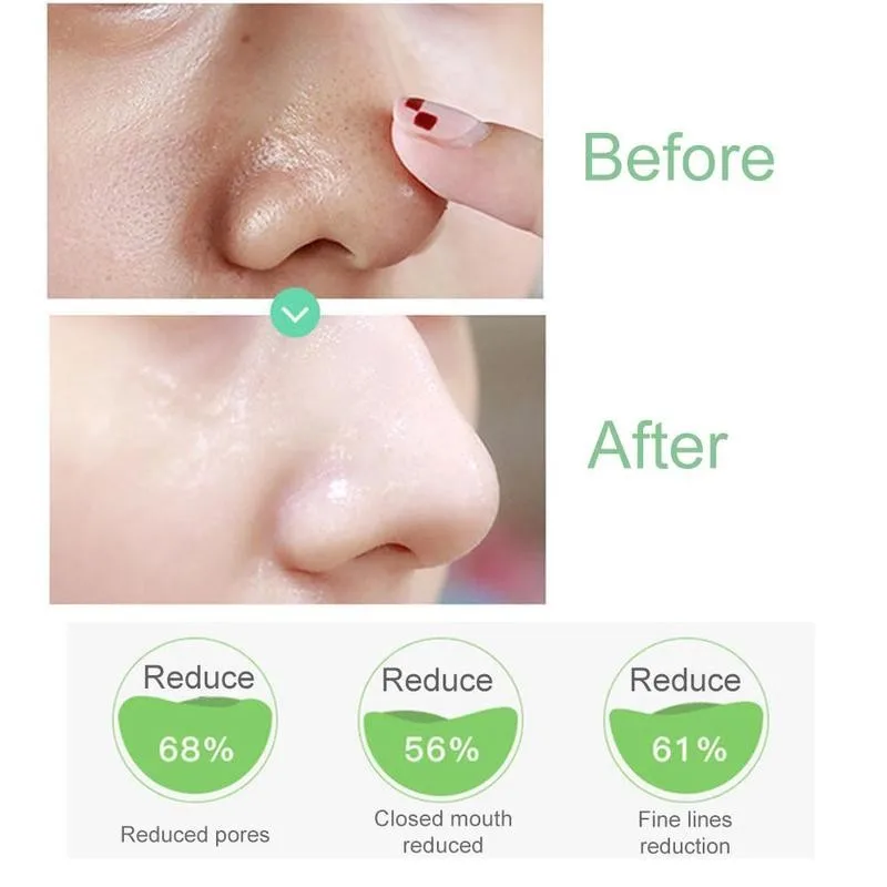 60ml Pore Corset Serum Pore Tightening Essence Deep Cleansing Whitening Soothes Skin Essecne Serum Skin Care
60ml Pore Corset Serum Pore Tightening Essence Deep Cleansing Whitening Soothes Skin Essecne Serum Skin Care