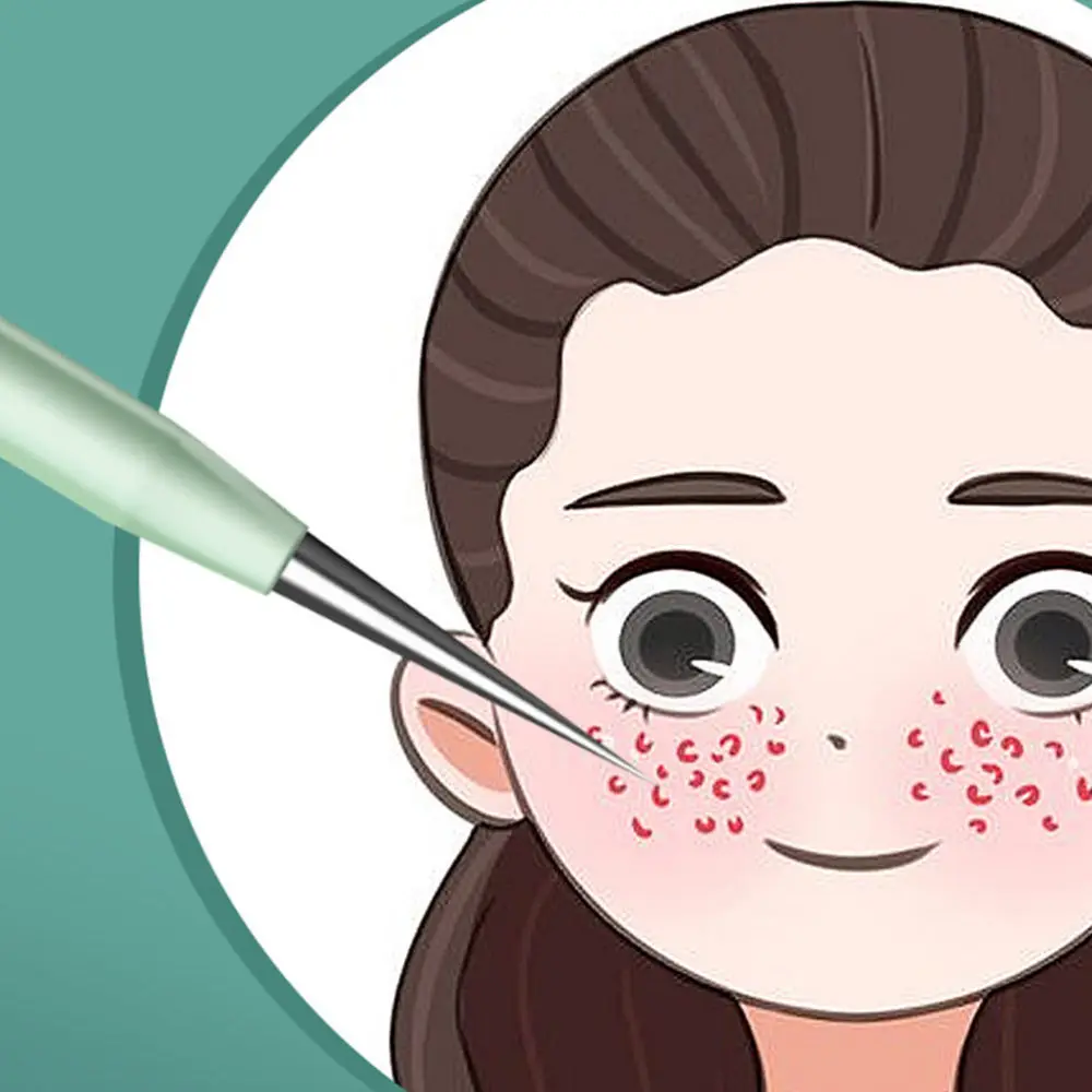 1 Set 6 Pcs Convenient Pimple Tweezers Wear-resistant Acne Clips (Green)
1 Set 6 Pcs Convenient Pimple Tweezers Wear-resistant Acne Clips (Green)