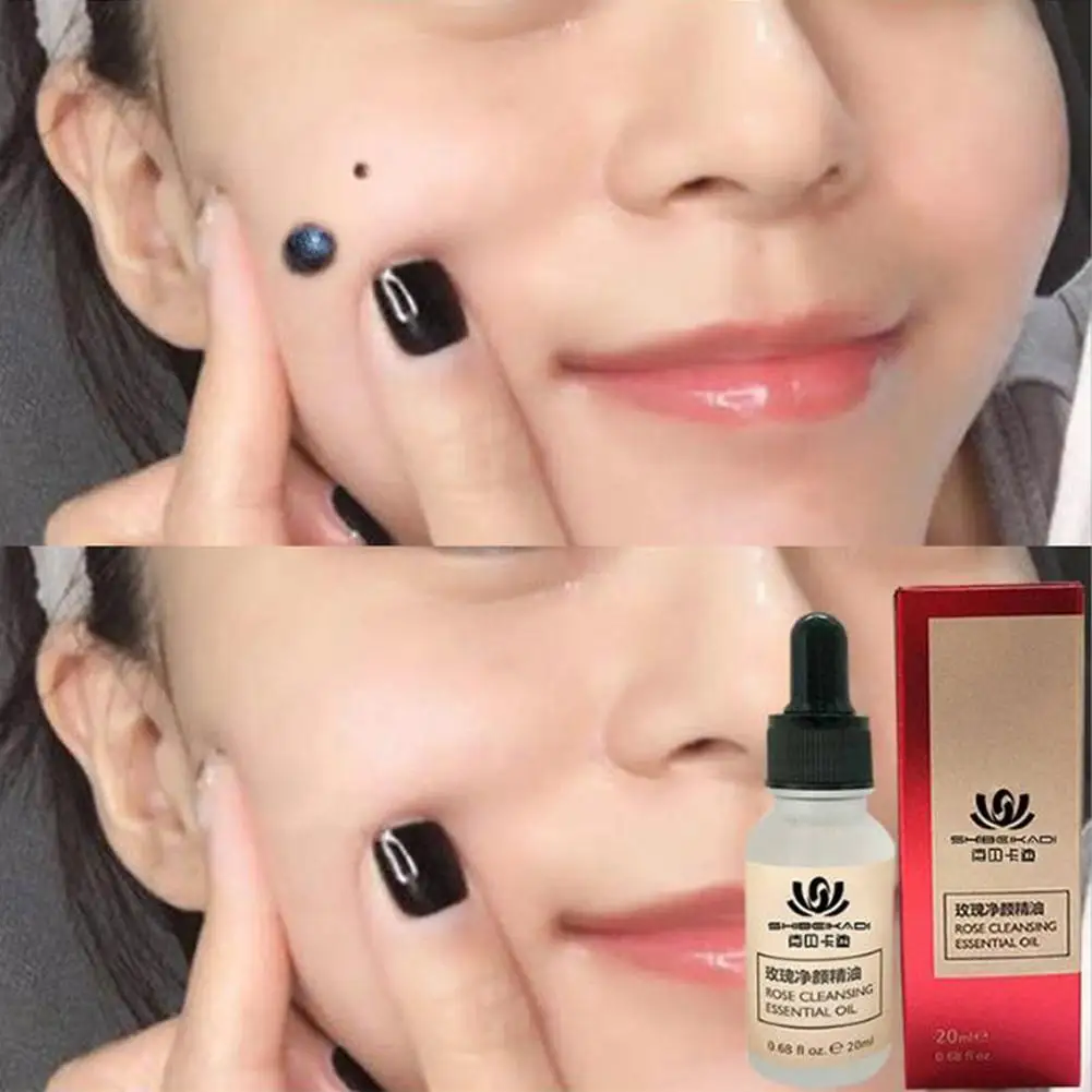 New Mole Water Essential Oil Painless Skin Dark Spot Face Tag Wart Cream Removal Removal Freckle For Women Girls T1L8
New Mole Water Essential Oil Painless Skin Dark Spot Face Tag Wart Cream Removal Removal Freckle For Women Girls T1L8