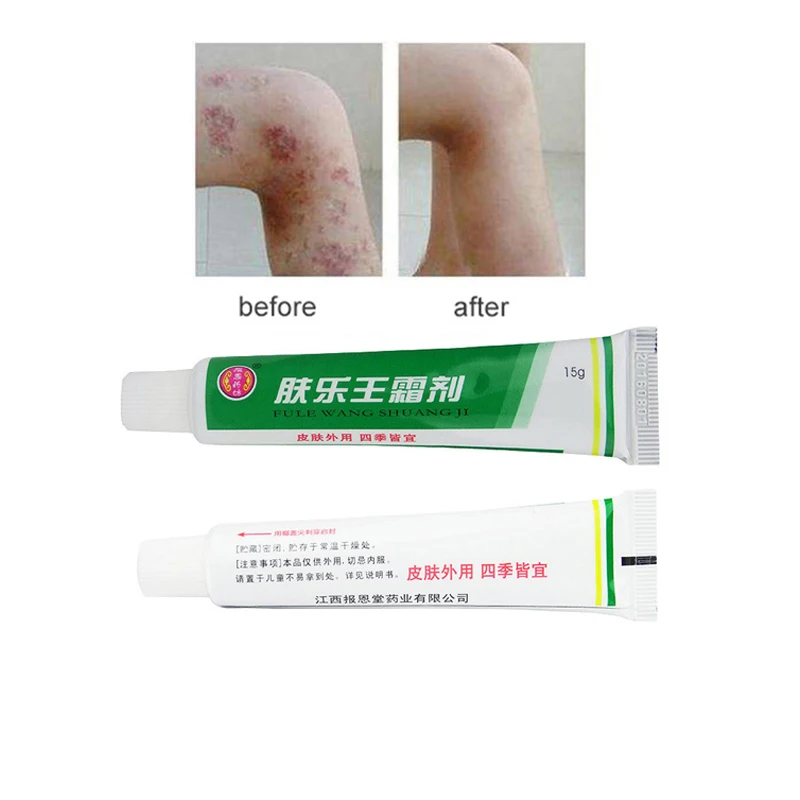 20PCS FULEWANG Skin Psoriasis Cream Dermatitis Eczematoid Eczema Ointment Treatment Psoriasis Cream 15g
20PCS FULEWANG Skin Psoriasis Cream Dermatitis Eczematoid Eczema Ointment Treatment Psoriasis Cream 15g