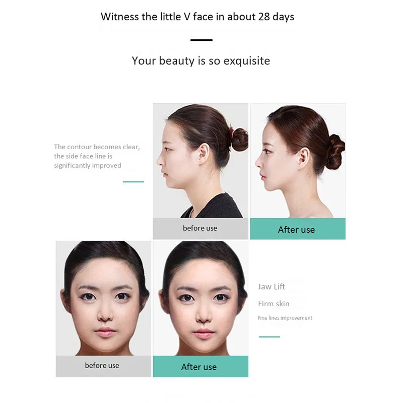 Facial Face Massager, Electric T Shape Face Massage Tools Instant Face Lift Anti-Wrinkles Skin Tightening Face Firming
Facial Face Massager, Electric T Shape Face Massage Tools Instant Face Lift Anti-Wrinkles Skin Tightening Face Firming