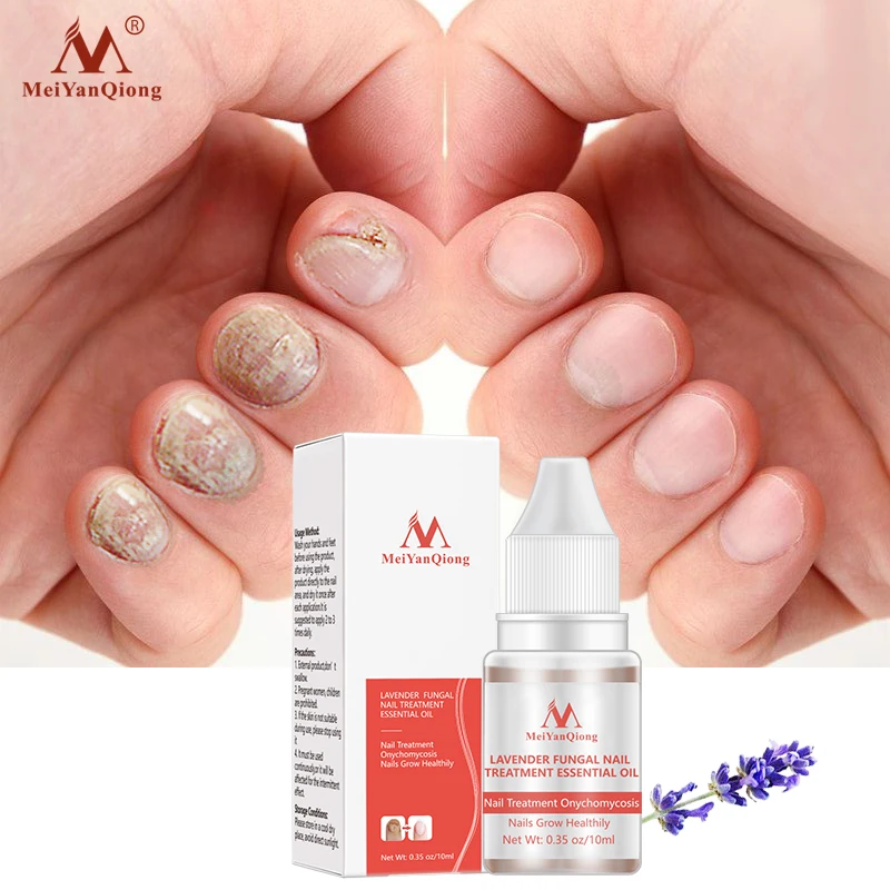 Nail Fungal Treatment Serum Onychomycosis Paronychia Herbal Anti-Fungal Nail Infection Toe Fungus Foot Repair Essence Care 10 ML
Nail Fungal Treatment Serum Onychomycosis Paronychia Herbal Anti-Fungal Nail Infection Toe Fungus Foot Repair Essence Care 10 ML