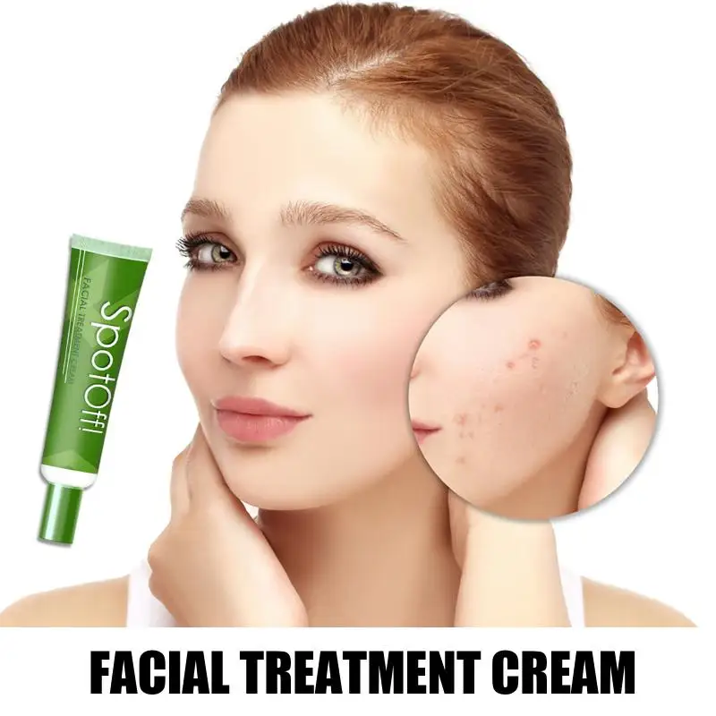 Лечит прыщи увлажняющий крем для лица против уход за кожей лица крем удаляющий Шрамы Акне, Управление масло крем по уходу за кожей TSLM1
Лечит прыщи увлажняющий крем для лица против уход за кожей лица крем удаляющий Шрамы Акне, Управление масло крем по уходу за кожей TSLM1