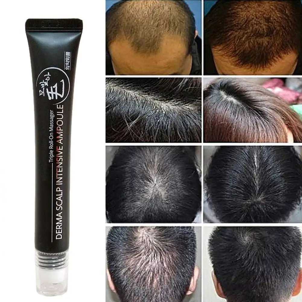 20ml Hair Line Growth Serum Derma Scalp Ampoule Hair Fast Roll Triple Massager Essence Loss Regrow Hair
20ml Hair Line Growth Serum Derma Scalp Ampoule Hair Fast Roll Triple Massager Essence Loss Regrow Hair