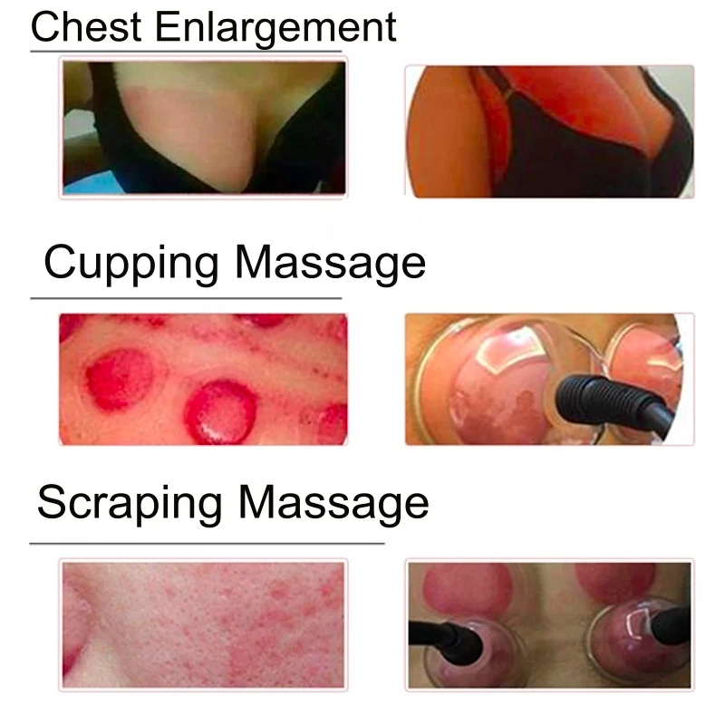 Vacuum Treatment Machine For Slimming Lymphatic Drainage Breast Chest Massager Enlargement Enhancement & Butt Lifting
Vacuum Treatment Machine For Slimming Lymphatic Drainage Breast Chest Massager Enlargement Enhancement & Butt Lifting