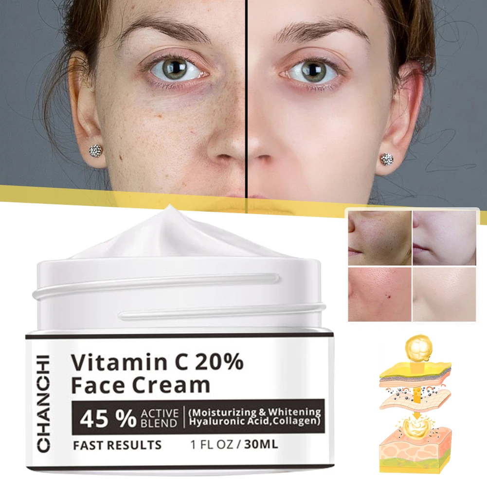 CHANCHI 30ml Face Cream 20% Vitamin C Whitening Anti-Aging Cream Brightening Lift Dark Spots Removal Facial Cream Brighten Skin
CHANCHI 30ml Face Cream 20% Vitamin C Whitening Anti-Aging Cream Brightening Lift Dark Spots Removal Facial Cream Brighten Skin
