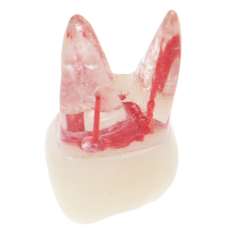 1 шт. 1:1 смола стоматологический эндододонтик Студенческая Модель для обучения с