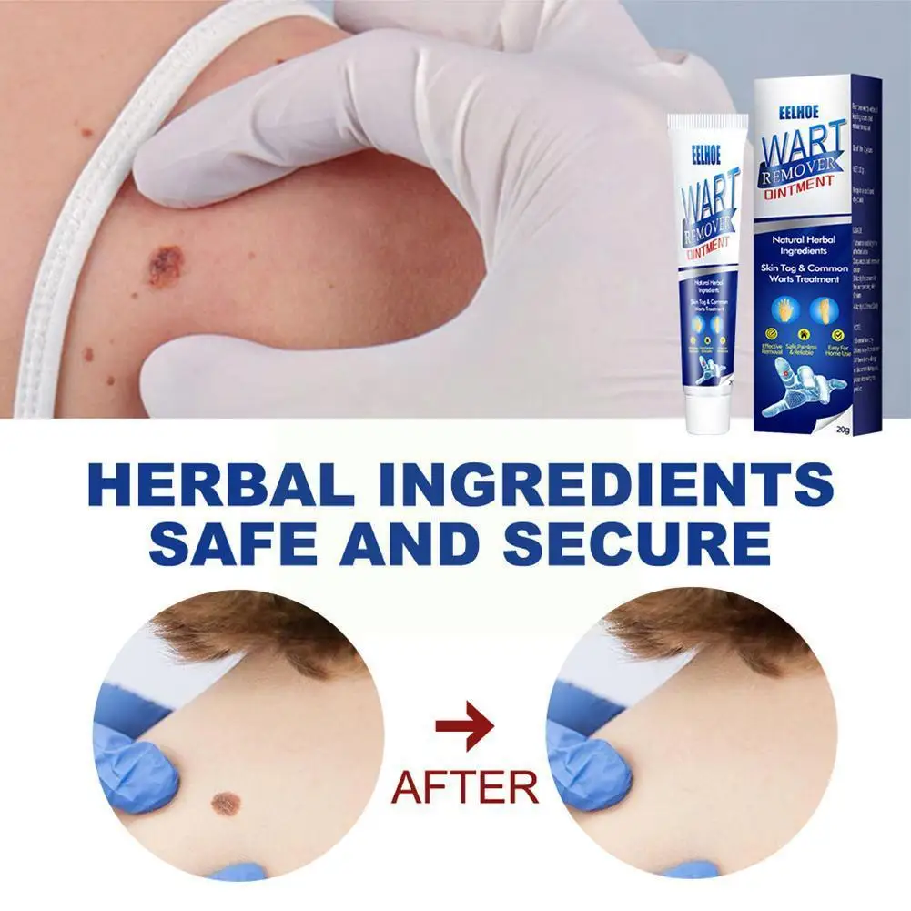 1pcs 20g Instant Blemish Removal Gel Wart Removal Body Cream Cream Care Warts Remover Treatment Wart Skin Tag Foot Cream M5v5
1pcs 20g Instant Blemish Removal Gel Wart Removal Body Cream Cream Care Warts Remover Treatment Wart Skin Tag Foot Cream M5v5