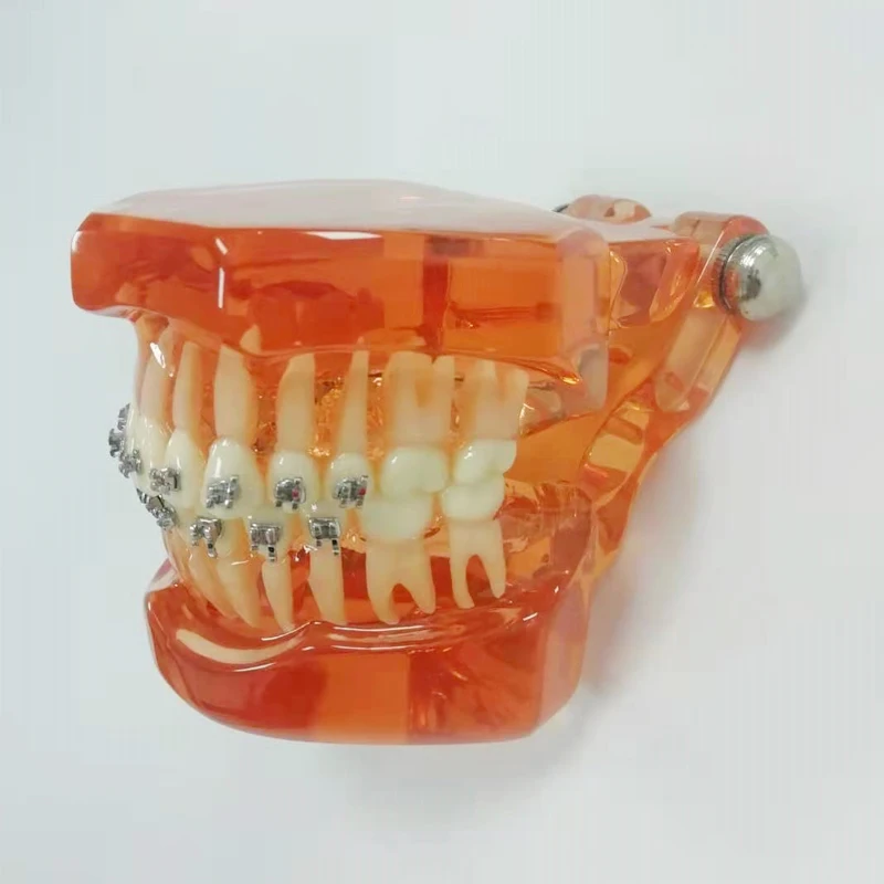 Dental M3001 Teeth Model With All Metal Bracket Demonstrates The Exact Position of Bracket,and Practice Wires,Ligature Ties
Dental M3001 Teeth Model With All Metal Bracket Demonstrates The Exact Position of Bracket,and Practice Wires,Ligature Ties
