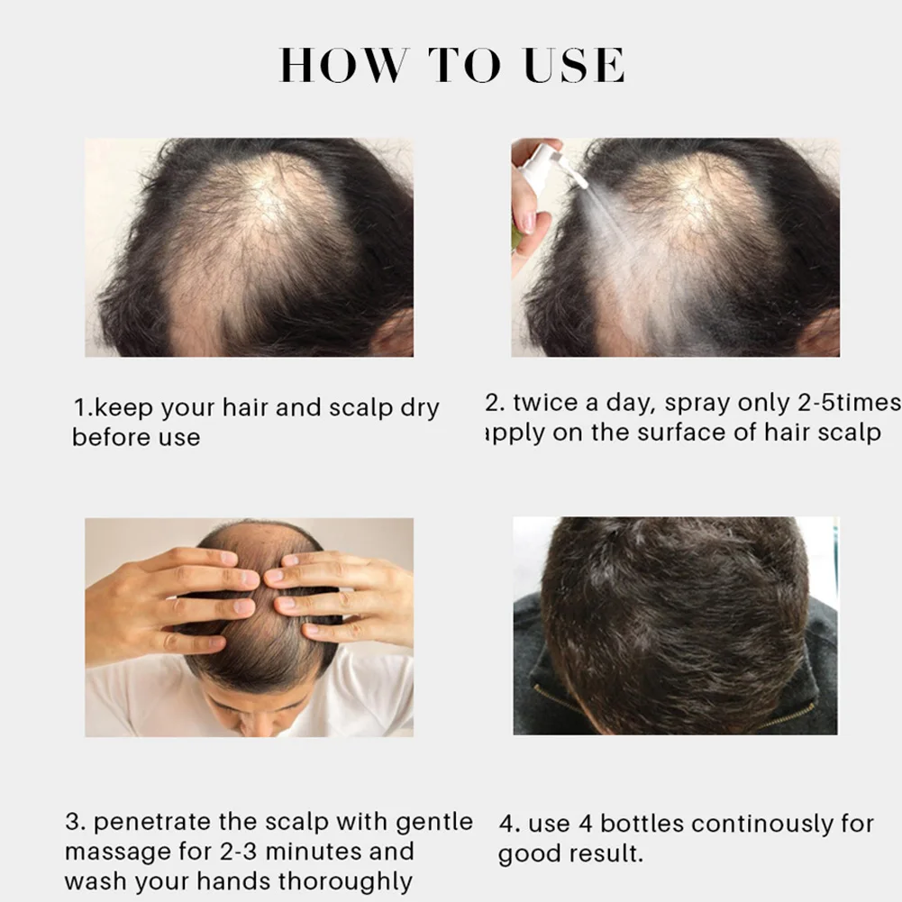 30ml Women Men Anti Loss Fast Essence Treatment Oil Eyebrows Hair Growth Serum Intensive Spray Home Salon Unisex Thickening
30ml Women Men Anti Loss Fast Essence Treatment Oil Eyebrows Hair Growth Serum Intensive Spray Home Salon Unisex Thickening