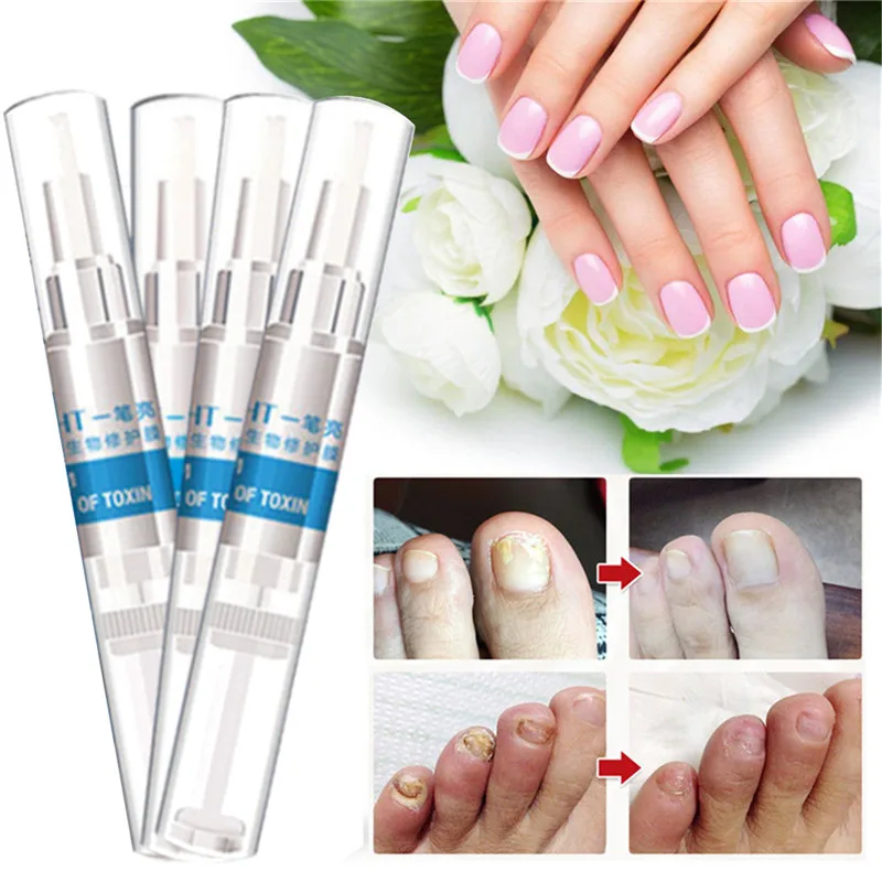 4pcs/box Nail Repair Pencil Infection Nail Toes Fungal Treatment Anti Fungus Biological Repair Protects From Discoloration
4pcs/box Nail Repair Pencil Infection Nail Toes Fungal Treatment Anti Fungus Biological Repair Protects From Discoloration