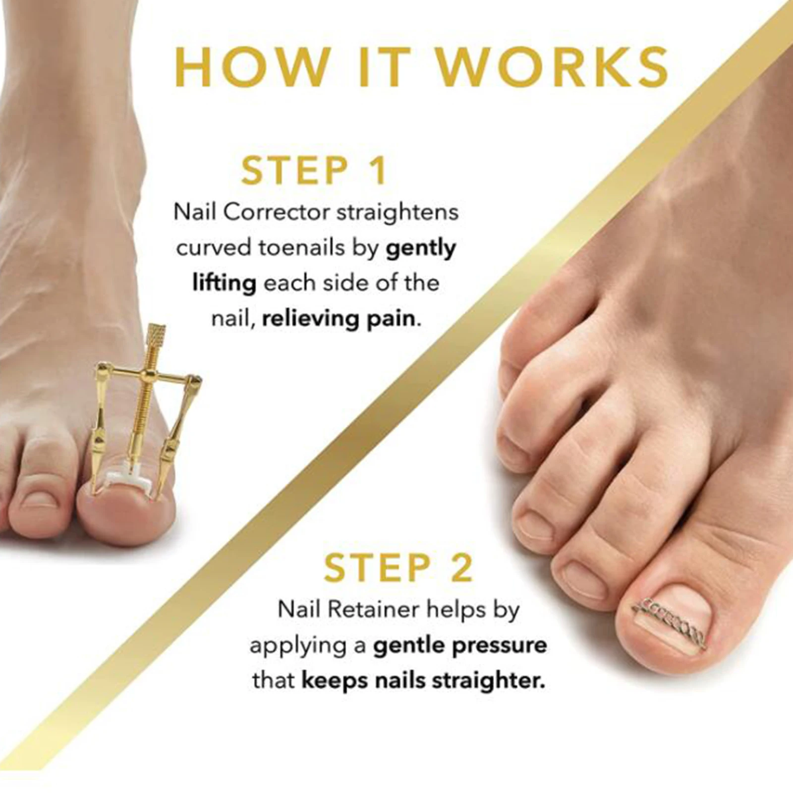 Professional Ingrown Toenail Correction Straightening Clip Fixer Recover Toe Nail Lifter Clamp Tweezer Wire Foot Pedicure Tool
Professional Ingrown Toenail Correction Straightening Clip Fixer Recover Toe Nail Lifter Clamp Tweezer Wire Foot Pedicure Tool