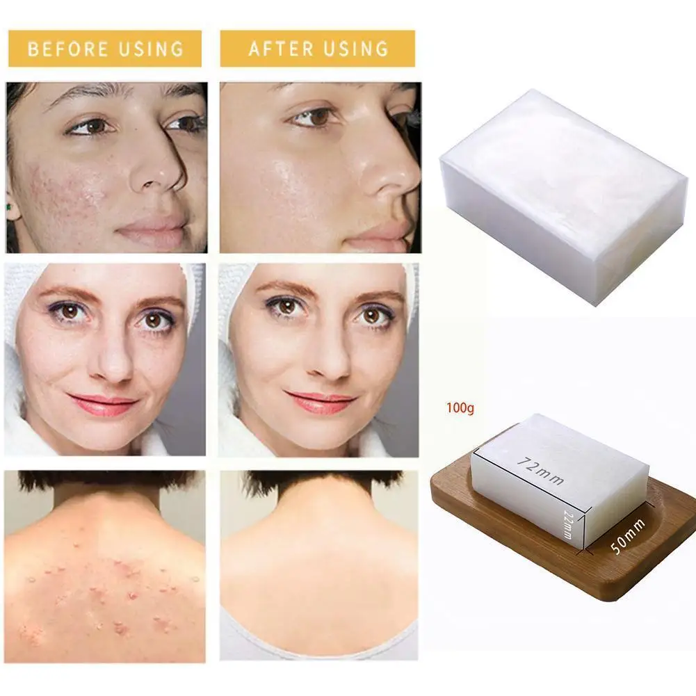 100g Kojic Acid Soap Handmade Soaps Glutathione Whitening Soap Cleanser Facial Wash Soap Bath Soap Soap Hand Antibacterial Y6W1
100g Kojic Acid Soap Handmade Soaps Glutathione Whitening Soap Cleanser Facial Wash Soap Bath Soap Soap Hand Antibacterial Y6W1