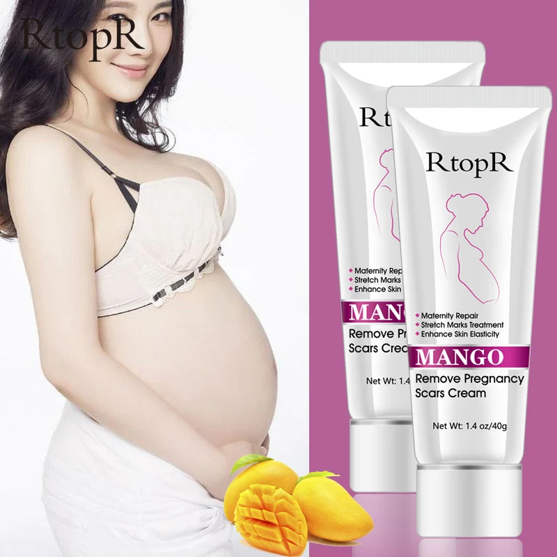Mango Stretch Marks Repair Cream Remove Pregnancy Scars Acne Treatment Maternity Anti-Aging Anti Winkles Firming Body Creams
Mango Stretch Marks Repair Cream Remove Pregnancy Scars Acne Treatment Maternity Anti-Aging Anti Winkles Firming Body Creams
