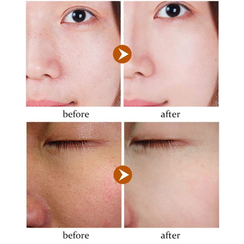 Anti Aging Anti-Wrinkle Cream Face Cream Acne Pimple Spot Resveratrol Whitening Moisturizing Facial Cream
Anti Aging Anti-Wrinkle Cream Face Cream Acne Pimple Spot Resveratrol Whitening Moisturizing Facial Cream