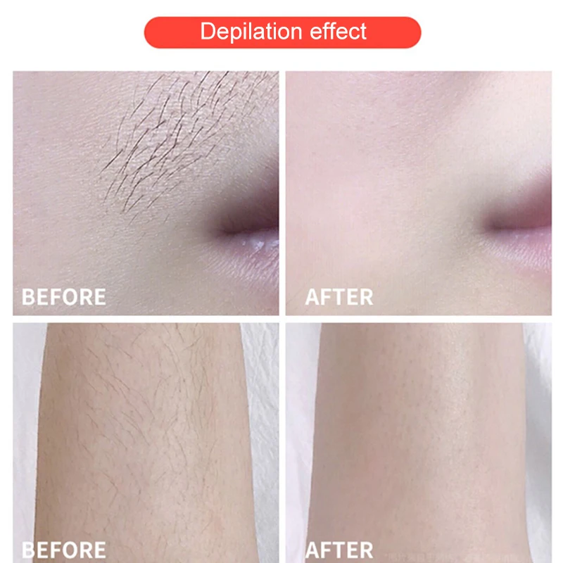 Hair Removal Device for Women and Man Painless Ice Feeling Hair Remover Wholebody Home Use
Hair Removal Device for Women and Man Painless Ice Feeling Hair Remover Wholebody Home Use