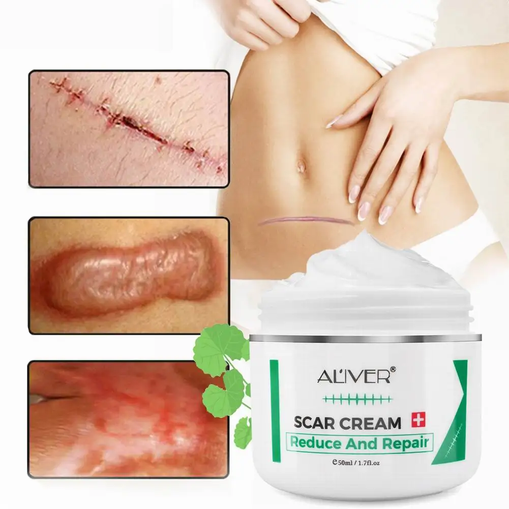 New Scar Removal Cream Face Cream For Face Acne Scar Stretch Marks Remover Cream Skin Repair Face Cream Acne Spots BaKe shipping
New Scar Removal Cream Face Cream For Face Acne Scar Stretch Marks Remover Cream Skin Repair Face Cream Acne Spots BaKe shipping