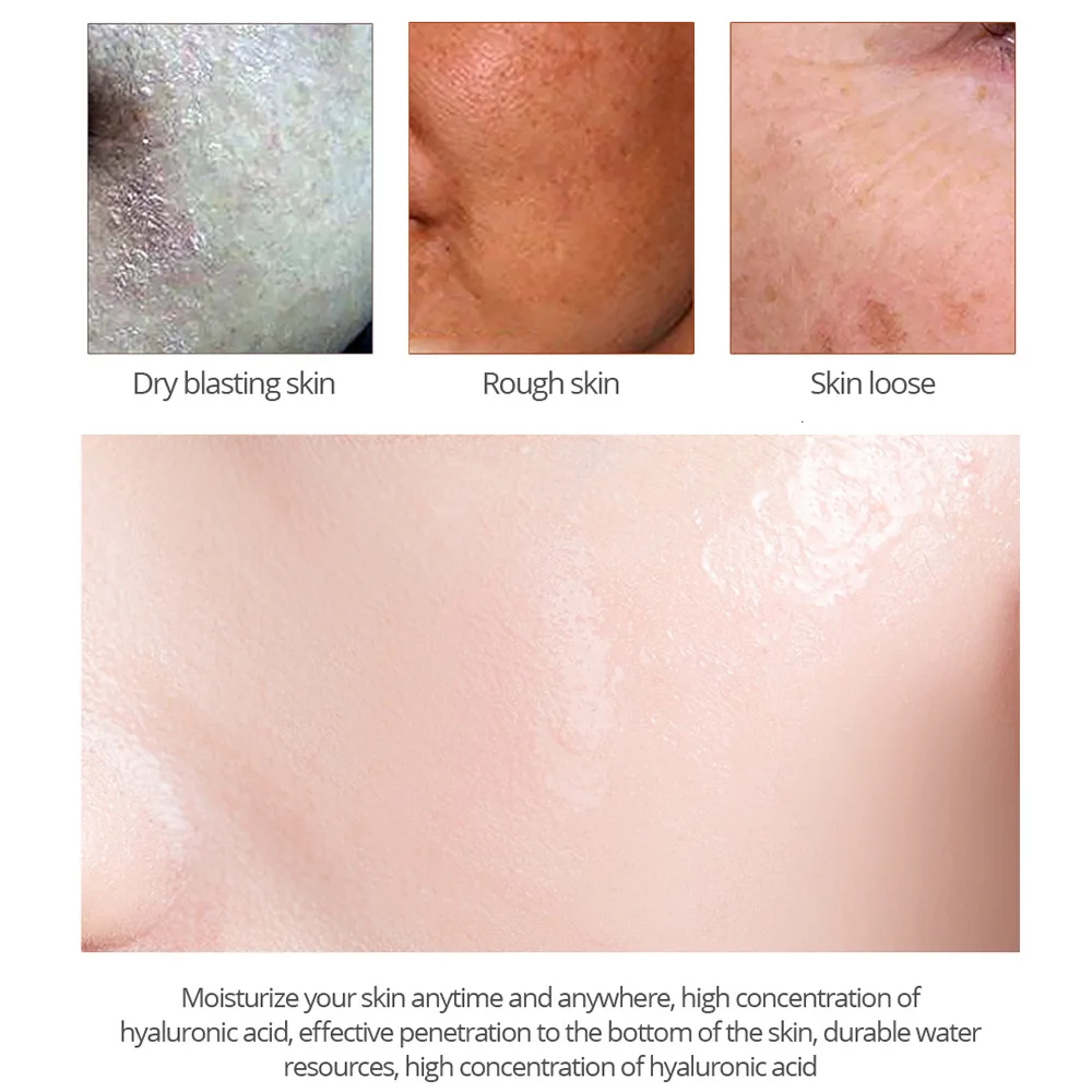 VOVA Hyaluronic Acid Face Cream Serum Anti Aging Shrink Pores Anti Wrinkle Facial Creams For Skin Whitening Day Cream Fast Ship
VOVA Hyaluronic Acid Face Cream Serum Anti Aging Shrink Pores Anti Wrinkle Facial Creams For Skin Whitening Day Cream Fast Ship