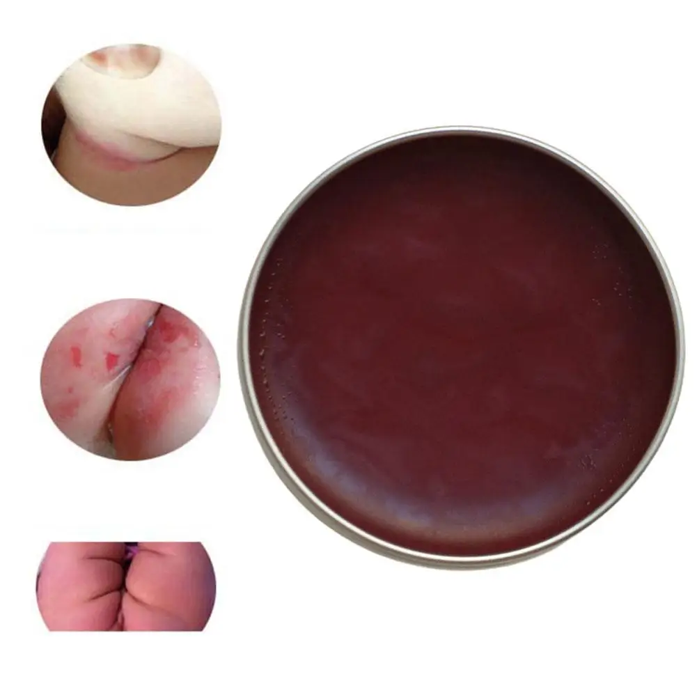 Lithospermum Diaper Cream Inner Thigh Whitening Cream Inner Action Fast Spots Thigh Remover Spotless J3E7
Lithospermum Diaper Cream Inner Thigh Whitening Cream Inner Action Fast Spots Thigh Remover Spotless J3E7