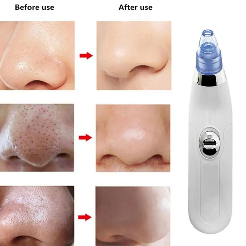 New Facial Blackhead Remover Electric Acne Cleaner Blackhead Black Point Vacuum Cleaner Tool Black Spots Pore Cleaner Machine
New Facial Blackhead Remover Electric Acne Cleaner Blackhead Black Point Vacuum Cleaner Tool Black Spots Pore Cleaner Machine
