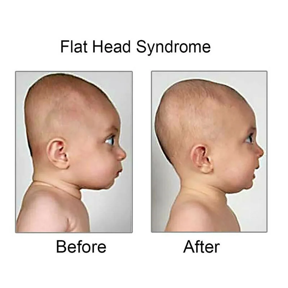 Anti Flat Head Baby Pillow Newborn Memory Nursing Sleep Support Cushion AntiRoll Shaping Pillow For Infant Neck Subject Bedding
Anti Flat Head Baby Pillow Newborn Memory Nursing Sleep Support Cushion AntiRoll Shaping Pillow For Infant Neck Subject Bedding