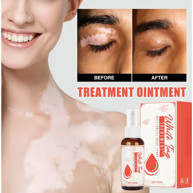 50ml White Spot VitiligoTreament Cream Antibacterial Spray Psoriasis Localized Vitiligo Ointment Mycosis Leukoplakia Treatment
50ml White Spot VitiligoTreament Cream Antibacterial Spray Psoriasis Localized Vitiligo Ointment Mycosis Leukoplakia Treatment