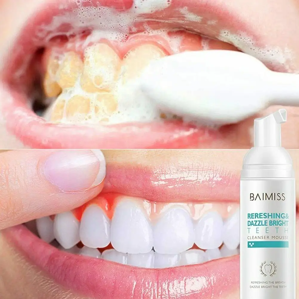 Hyun White Toothpaste Teeth Whitening Mousse Toothpaste Breath Tooth Teeth Tooth-cleaning Bad Deal To Stains Shining O6c3
Hyun White Toothpaste Teeth Whitening Mousse Toothpaste Breath Tooth Teeth Tooth-cleaning Bad Deal To Stains Shining O6c3