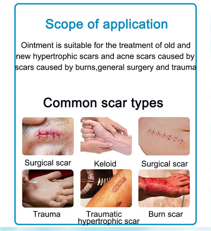 5Pcs Scar Removal Cream Face Cream For Face Acne Scar Stretch Marks Remover Cream Skin Repair Face Cream Acne Spots
5Pcs Scar Removal Cream Face Cream For Face Acne Scar Stretch Marks Remover Cream Skin Repair Face Cream Acne Spots