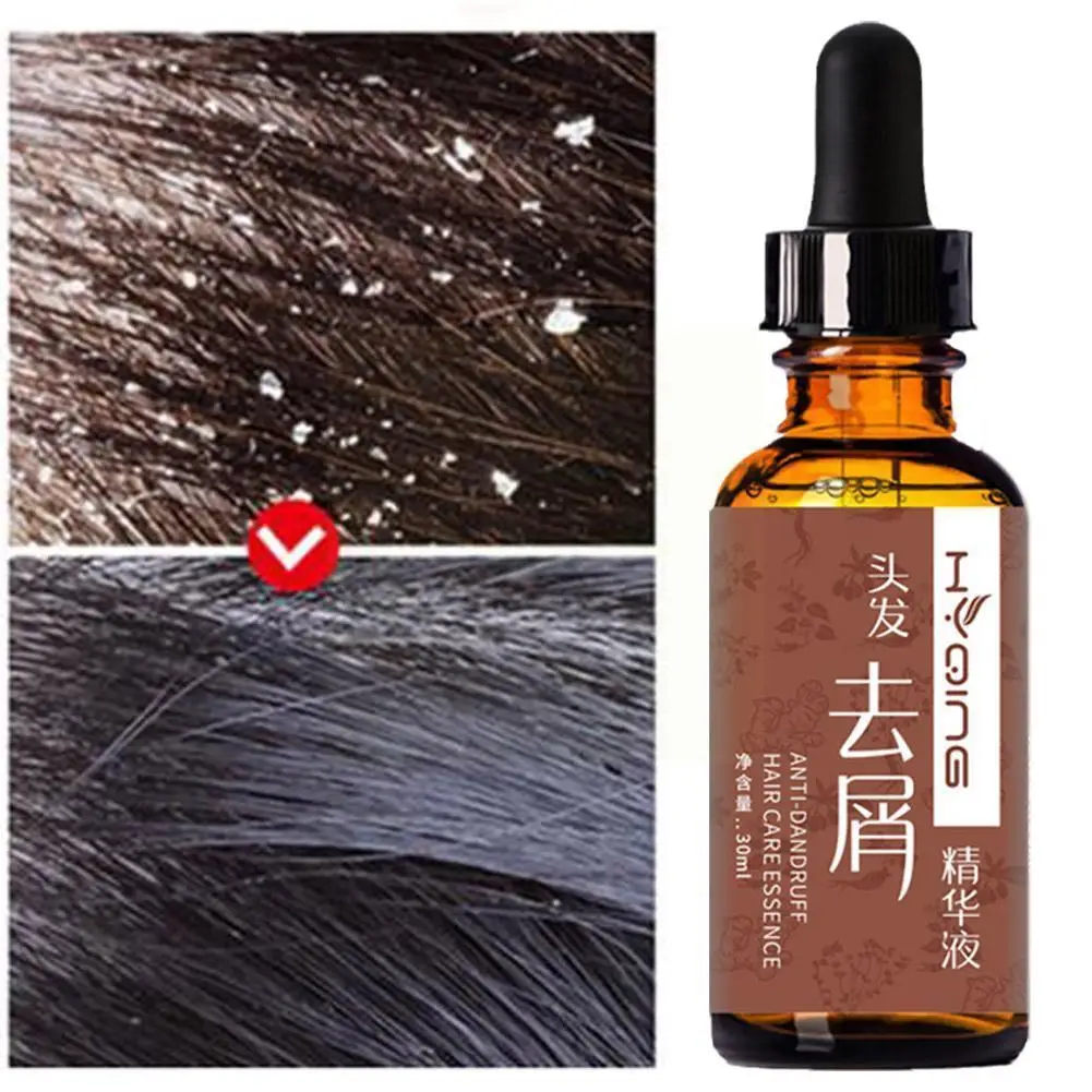 30ml Anti-dandruff And Itch Removing Hair Essential Repair Hair Care Nourishing Oil Hair Moisturizing T6b1
30ml Anti-dandruff And Itch Removing Hair Essential Repair Hair Care Nourishing Oil Hair Moisturizing T6b1