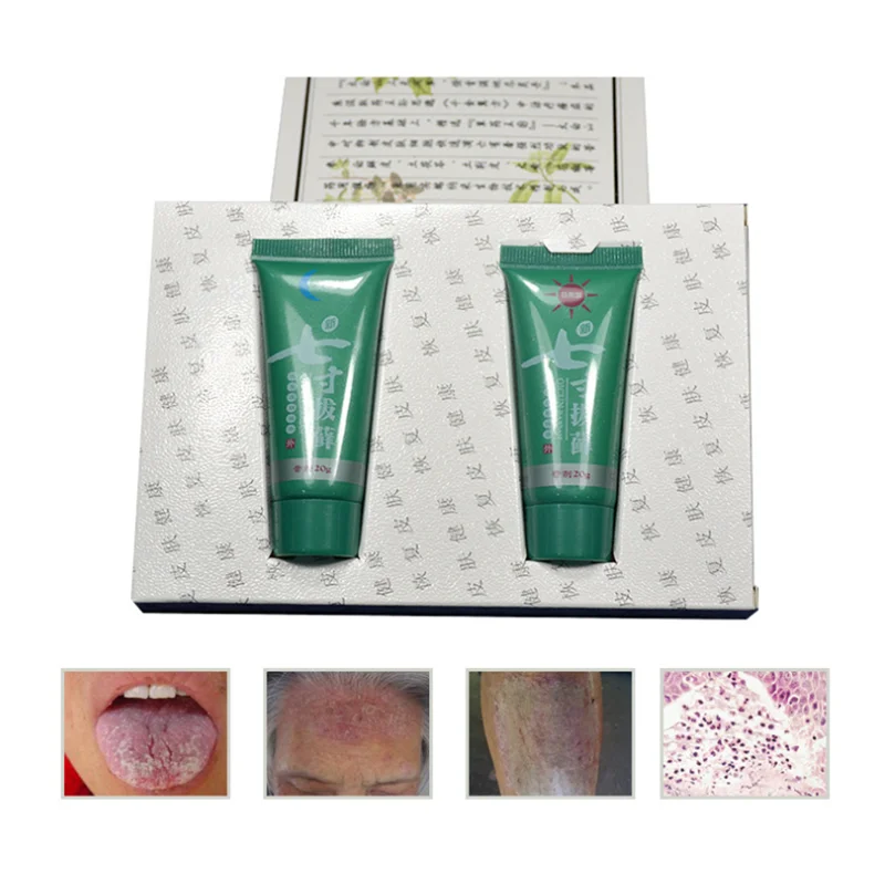 Day + Night Psoriasis Body Cream Dermatitis Eczematoid Eczema Ointment Sterilization Skin Psoriasis Treatment Cream Skin Care
Day + Night Psoriasis Body Cream Dermatitis Eczematoid Eczema Ointment Sterilization Skin Psoriasis Treatment Cream Skin Care