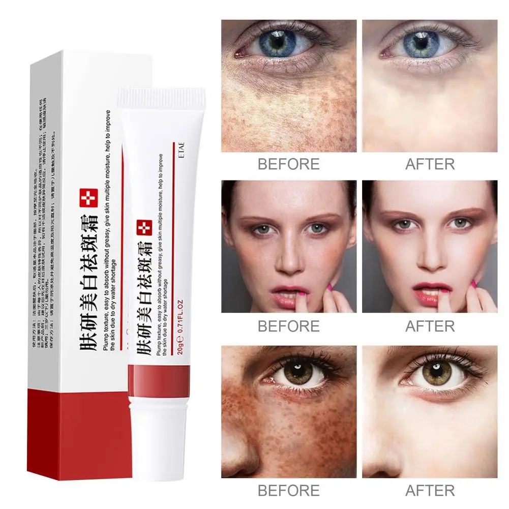 Face Cream Dark Spot Corrector Anti-Aging Whitening Moisturizing Remove Sunburn Dark Spots And Acne Pigmentation Repair Freckles
Face Cream Dark Spot Corrector Anti-Aging Whitening Moisturizing Remove Sunburn Dark Spots And Acne Pigmentation Repair Freckles