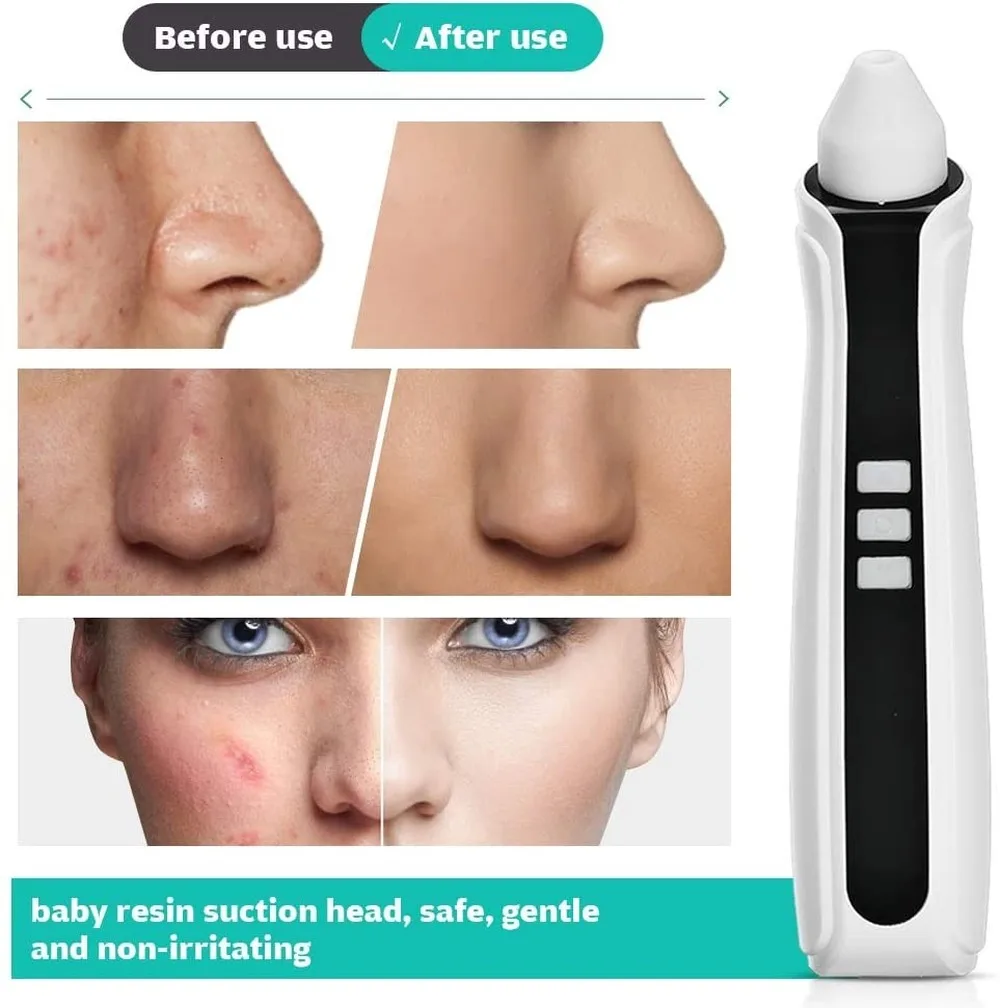 WIFI Visual Electric Blackhead Remover Vacuum with 20X Microscope Camera Suction Pore Cleaner Pore Vacuum Acne Comedone Tools
WIFI Visual Electric Blackhead Remover Vacuum with 20X Microscope Camera Suction Pore Cleaner Pore Vacuum Acne Comedone Tools
