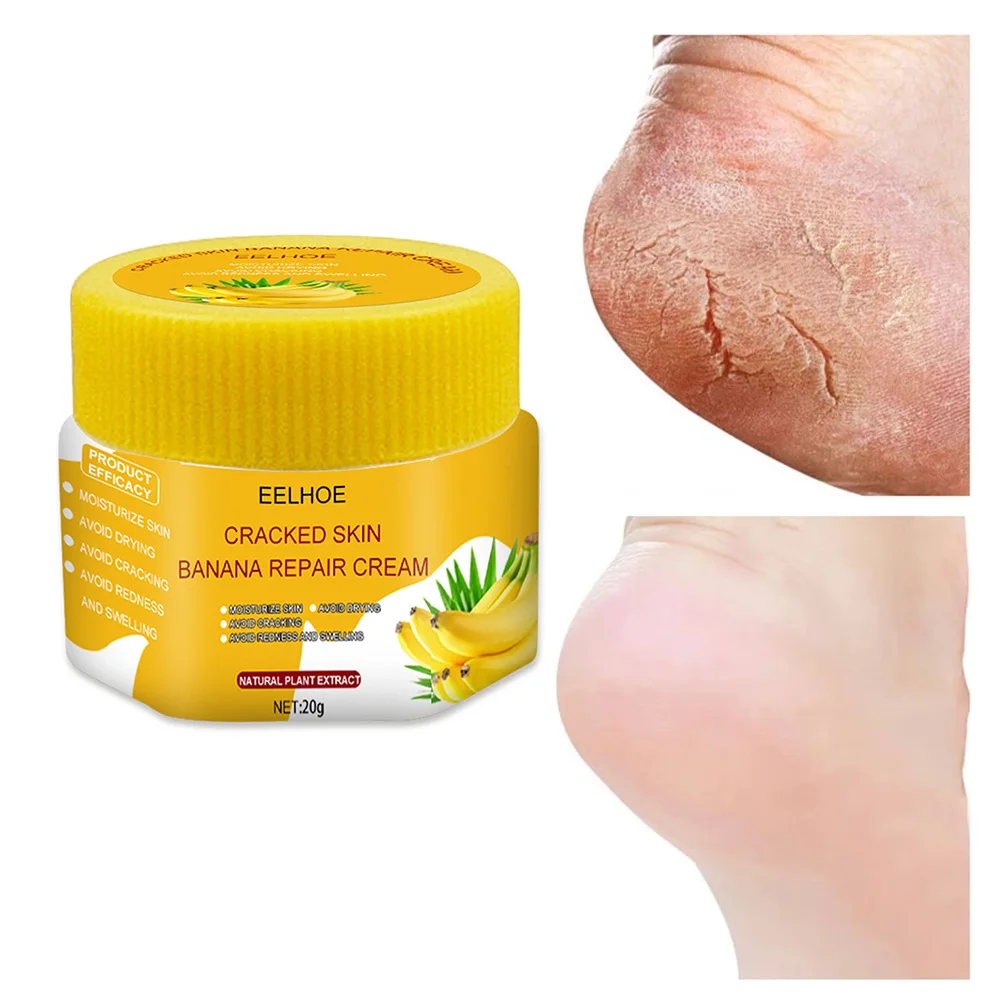 1Pcs 20g Foot Repair Cream Fast Relief for Dryness Roughness Cracked Feet Heels Hands Moisturize Nourish Cream for Hand Foot
1Pcs 20g Foot Repair Cream Fast Relief for Dryness Roughness Cracked Feet Heels Hands Moisturize Nourish Cream for Hand Foot