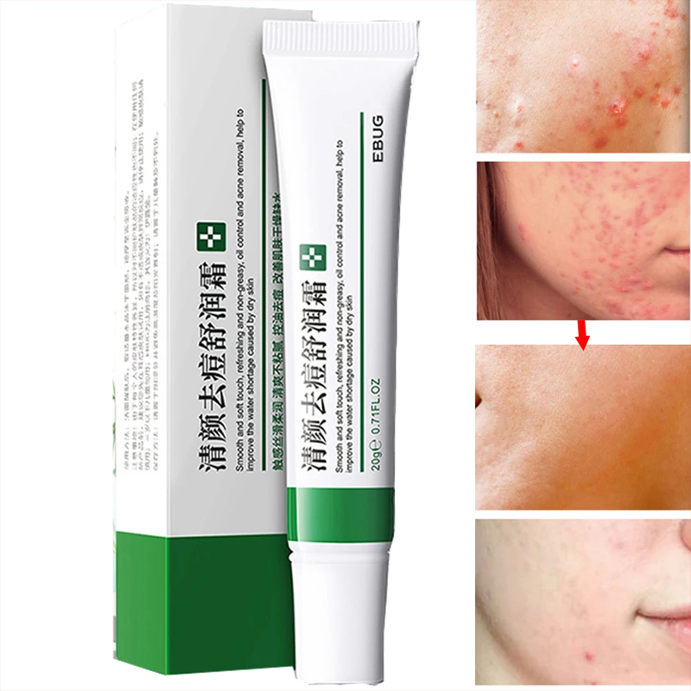 Acne Treatment Face Cream Acne Removal Cream Shrink Pores Whitening Moisturizing Oil Control Acne Cream Freckle Cream Skin Care
Acne Treatment Face Cream Acne Removal Cream Shrink Pores Whitening Moisturizing Oil Control Acne Cream Freckle Cream Skin Care