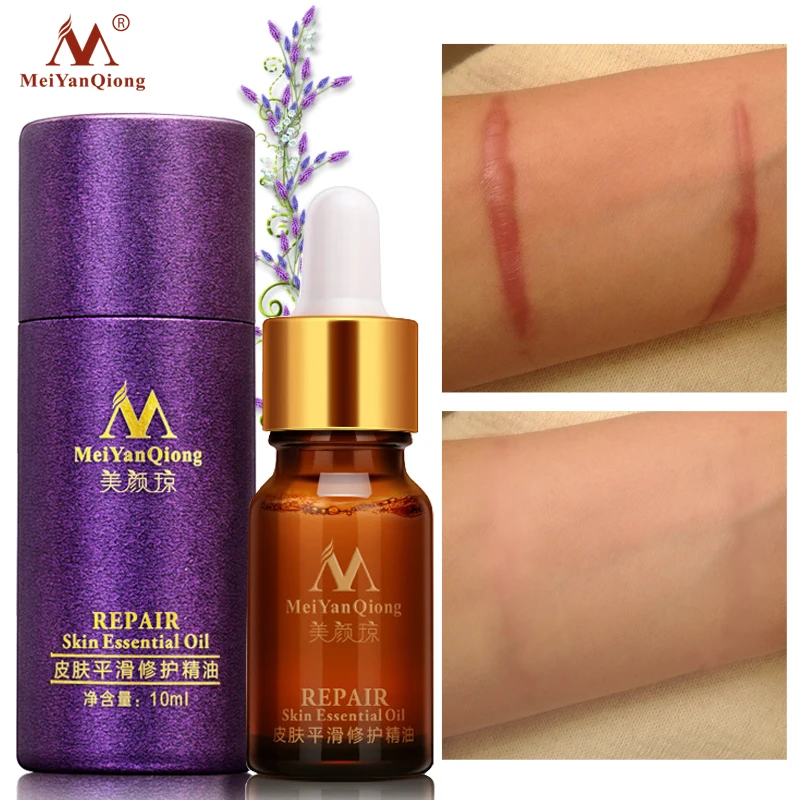 MeiYanQiong Scar Repair Smooth Skin Essential Oil Lavender Remove Fine Lines Scars Burn Marks Essence Moisturizing Body Care
MeiYanQiong Scar Repair Smooth Skin Essential Oil Lavender Remove Fine Lines Scars Burn Marks Essence Moisturizing Body Care