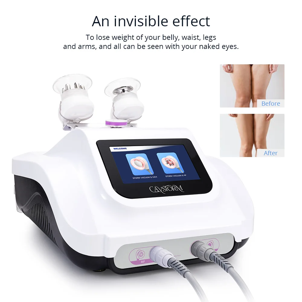 CaVstorm 40K Cavitation 3.0 Weight Loss RF Vacuum Cup Body Slimming RF Skin Wrinkle Remove Beauty Machine
CaVstorm 40K Cavitation 3.0 Weight Loss RF Vacuum Cup Body Slimming RF Skin Wrinkle Remove Beauty Machine