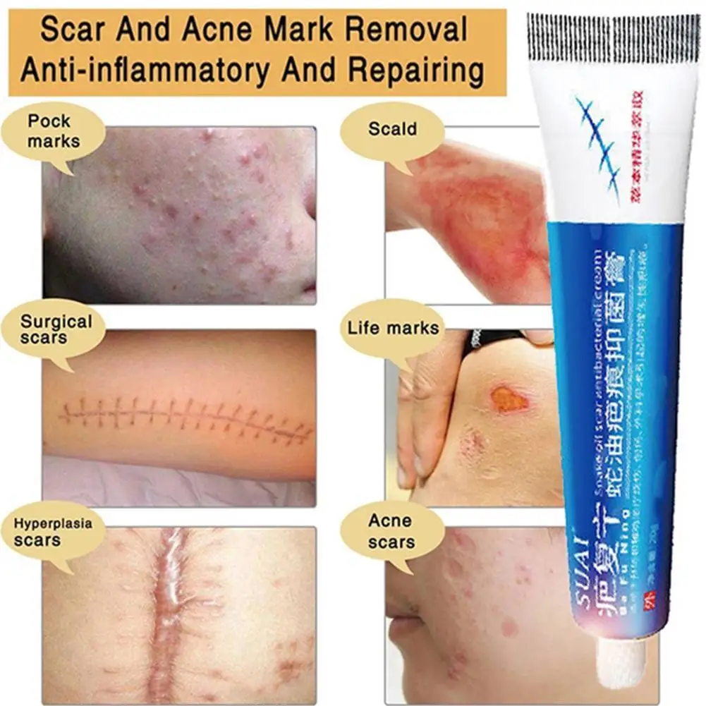 20g Acne Scar Removal Cream Pimples Stretch Marks Face Body Skin Acne Care Smoothing Gel Remove Moisturizing Whitening D0N3
20g Acne Scar Removal Cream Pimples Stretch Marks Face Body Skin Acne Care Smoothing Gel Remove Moisturizing Whitening D0N3