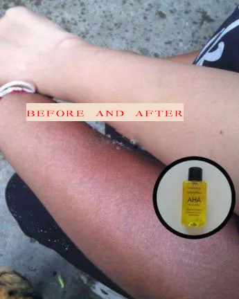 white AHA body serum bleaching brightening skin serum30 ml 
white AHA body serum bleaching brightening skin serum30 ml